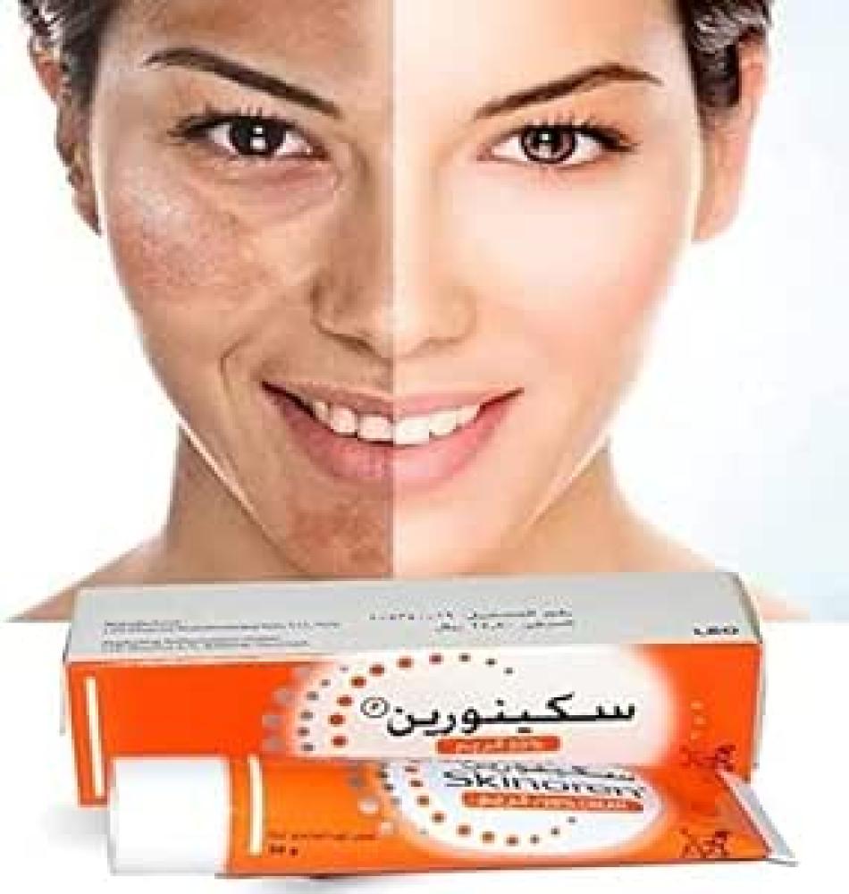 Skinoren whitening cream for All Skin Types (30g) skinoren whitening cream for all skin types 30g