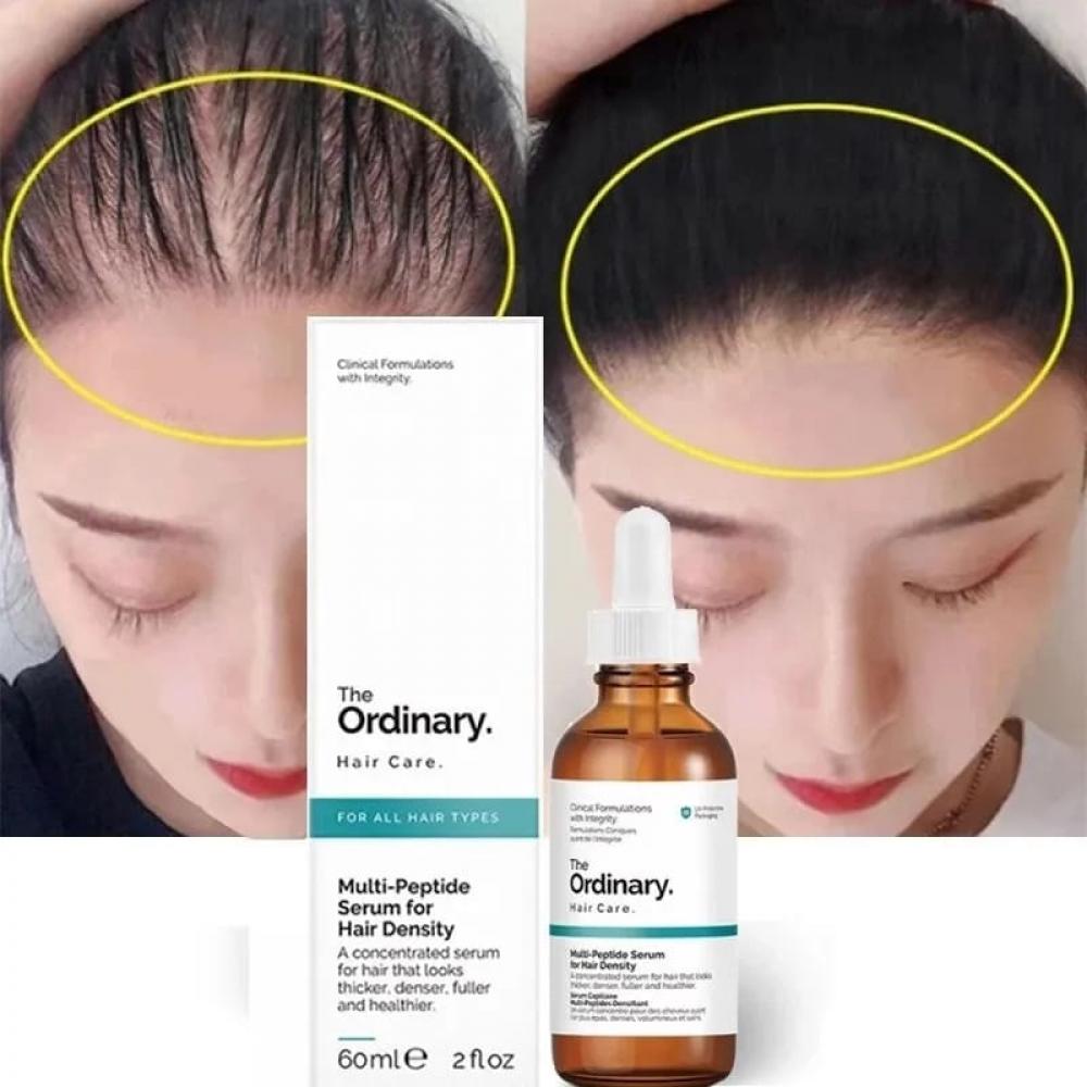 The ordinary сыворотка мультипептидная. Hair growth serum regeneration. The ordinary сыворотка мультипептидная. Ordinary для умывания. Multi peptide serum.
